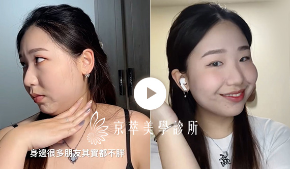 我不是胖,但就是有雙下巴